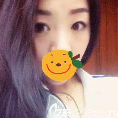 驻马店金玄宫眼综合术前 驻马店金玄宫眼综合术前