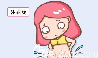 长妊娠纹的图片
