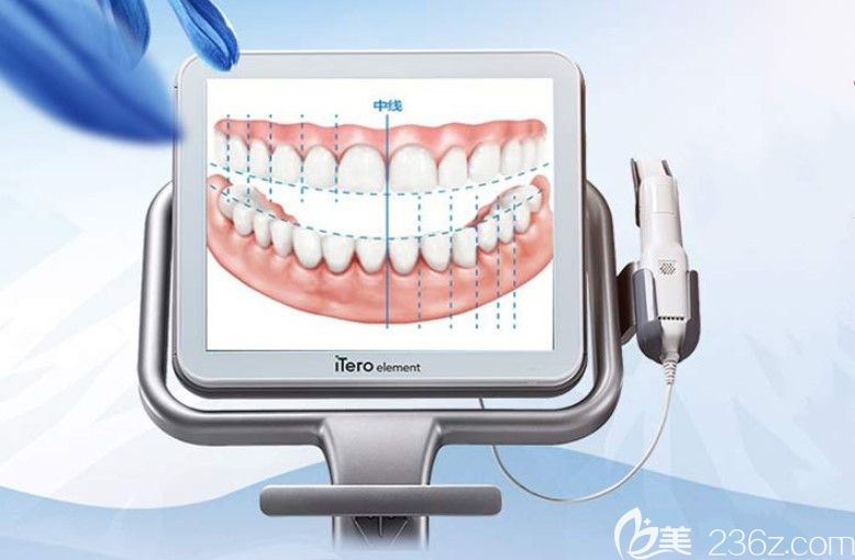 优贝口腔iTero口扫 优贝口腔iTero口扫