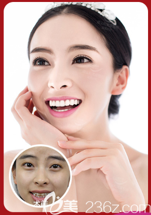 遵义利美康牙齿矫正 遵义利美康牙齿矫正