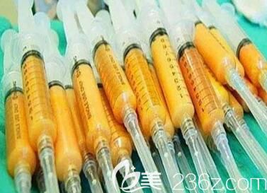 体脂肪填充面部到底可以维持多久？