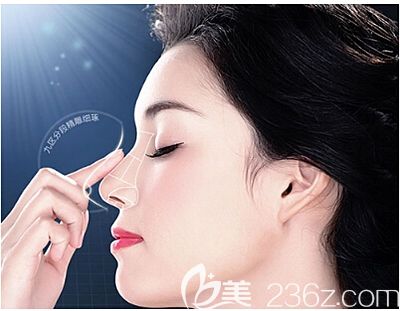 假体隆鼻可以改善鼻梁凹陷