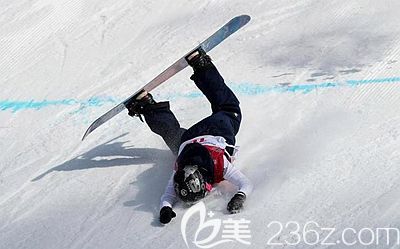 假体隆鼻术后要避免摔倒