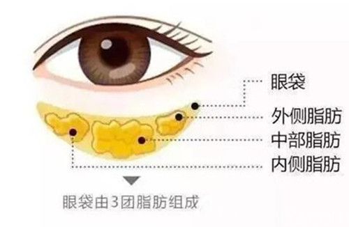 眼袋脂肪组成结构图