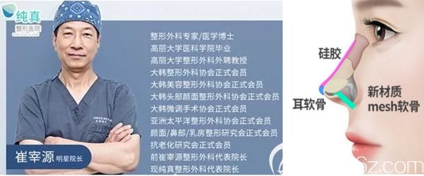 韩国纯真整形外科崔宰源隆鼻手术 韩国纯真整形外科崔宰源隆鼻手术