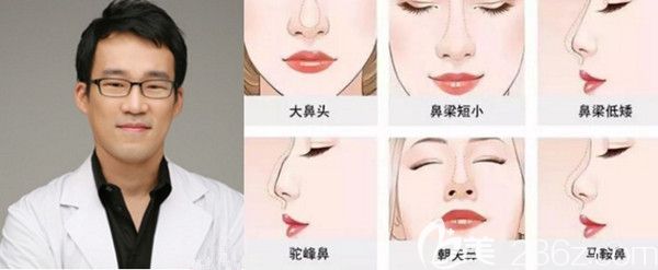 韩国碧夏整形医院李珉奭可以改善鼻型 韩国碧夏整形医院李珉奭可以改善鼻型