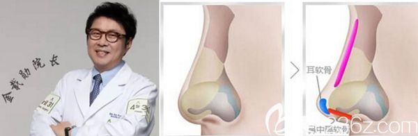 韩国4月31日整形外科金载勋隆鼻手术特色 韩国4月31日整形外科金载勋隆鼻手术特色