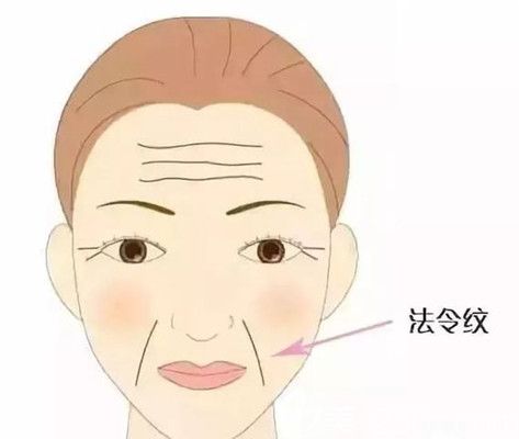 法令纹体现女性衰老的特征