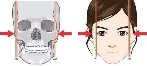 磨骨瘦脸后遗症的危害