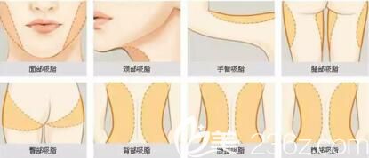 全身脂肪存在较多的部位