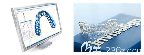 上饶维乐阳光口腔正畸口扫仪