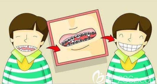 任茹冰医师科普儿童牙齿矫正的方法 任茹冰医师科普儿童牙齿矫正的方法