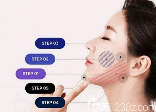 韩国美迪莹吸脂优势