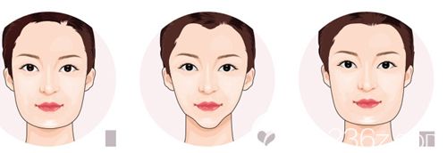 韩国ID美国铃铛先提升效果 韩国ID美国铃铛先提升效果