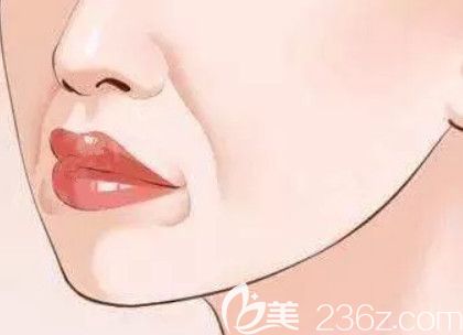 法令纹显得人很老气