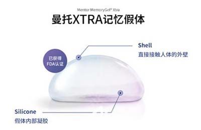 曼托新款记忆假体Xtra