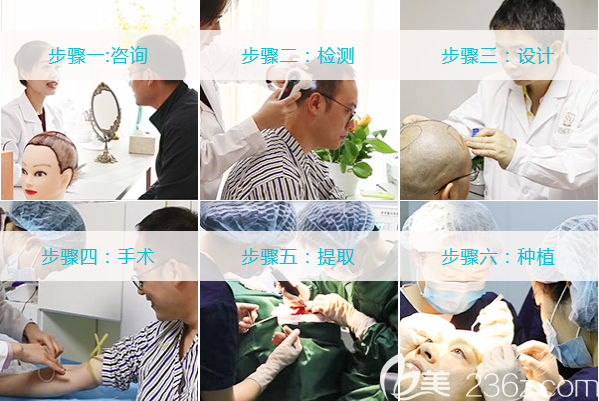 成都青羊首瑞毛发移植医疗美容诊所植发流程