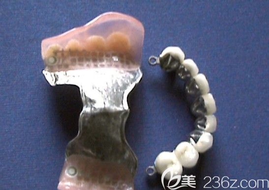 陈利明医生讲解活动义齿的基托有哪几种类型 陈利明医生讲解活动义齿的基托有哪几种类型