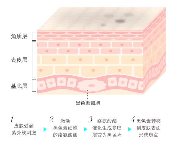 斑点的产生原因 斑点的产生原因
