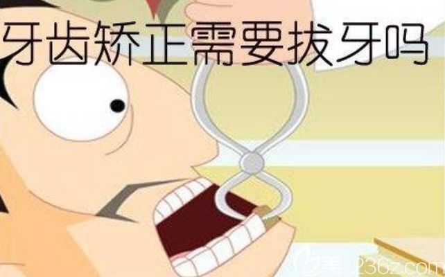 陈聪慧医生讲解整牙需要拔牙吗