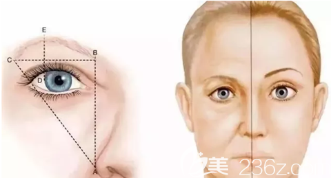 易韩整形提眉术可以显示面部年轻