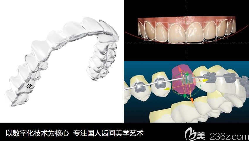 北京海德堡联合口腔正畸过程中实施全程监控 北京海德堡联合口腔正畸过程中实施全程监控