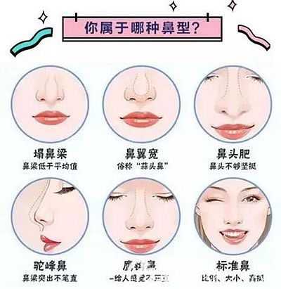 鼻部多种不美观的问题
