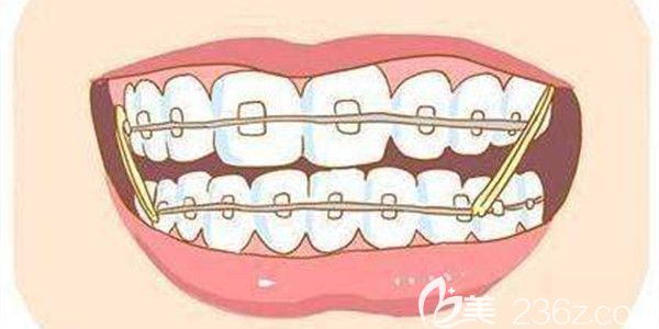 致美口腔经验丰富的正畸医生 致美口腔经验丰富的正畸医生