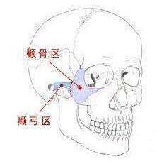 颧骨颧弓位置图