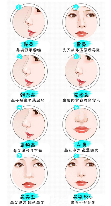 整形医院可以解决各种鼻型问题
