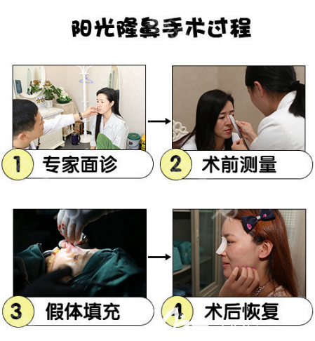 整形医院罗志敏隆鼻案例过程图