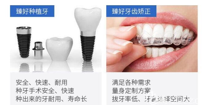 杭州臻好特色项目介绍图 杭州臻好特色项目介绍图