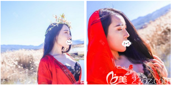 广州壹加壹整形医院隆胸怎么样 广州壹加壹整形医院隆胸怎么样