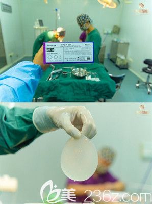 洛阳华美整形曼托假体隆胸手术