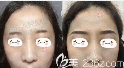 周口缔莱美纹眉前后的效果对比