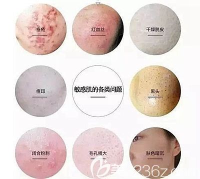 面部常见的皮肤问题