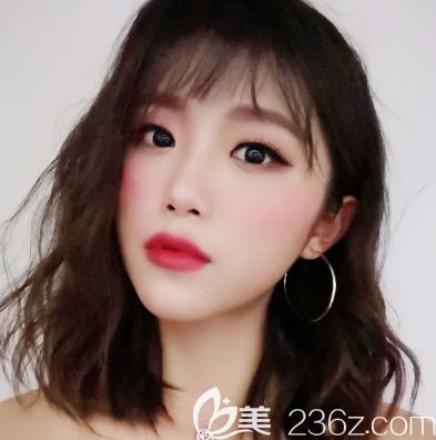 专程跑去广州爱来整形医院找余花主任做了自体脂肪面部填充和双眼皮,给大家看效果好不好