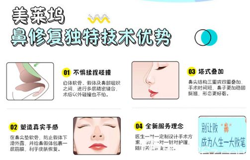 美莱坞鼻修复技术优势