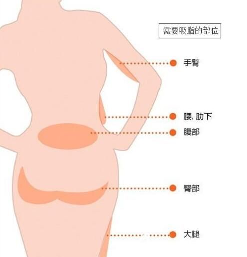 需要吸脂的部位展示