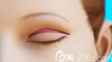 韩国清潭FIRST眼修复