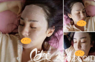 术后10天的样子 术后10天的样子