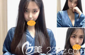 术后20天 术后20天