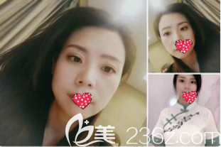 我也是做了一次双眼皮才知道医院怎么样？各方面来讲它的正规靠谱程度