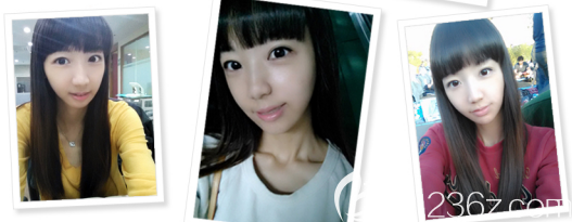 术后30天 术后30天