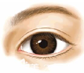 割双眼皮手术越来越受欢迎