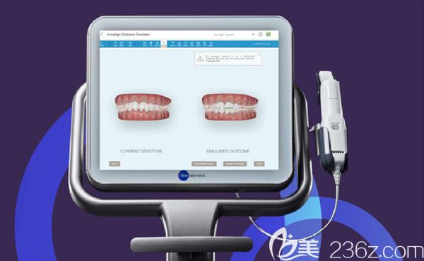 北京佳美口腔隐适美口扫仪器 北京佳美口腔隐适美口扫仪器