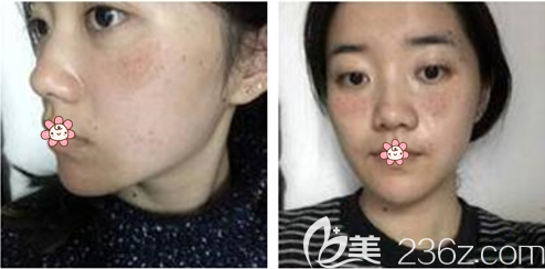 术前我的脸 术前我的脸