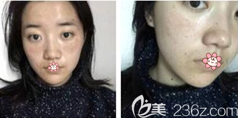 一周时候有一点点淡了 一周时候有一点点淡了