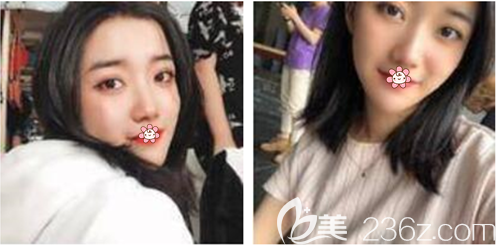 重庆美莱祛斑怎么样 重庆美莱祛斑怎么样