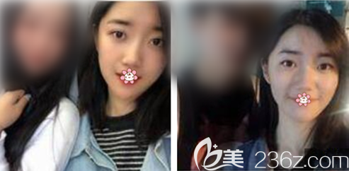 重庆美莱哪个医生祛斑好 重庆美莱哪个医生祛斑好